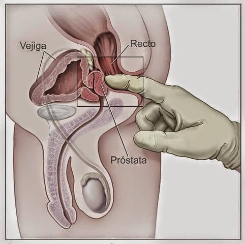 Próstata masculina